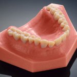 Neuer 3D-Drucker Objet260 für die Zahnmedizin