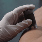 Komfortable Betäubung und Injektion