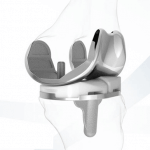 Conformis Kniegelenk