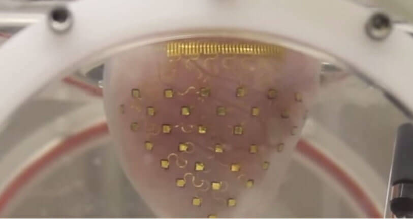 Herzschrittmacher aus 3D-Drucker