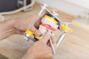 3D-Druck in der Zahnmedizin 3D-Druck in der Zahnmedizin