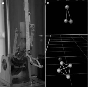 Forschungen an Knieproblemen mit dem 3D-Drucker