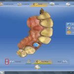 Screenshot CEREC SW 4.5