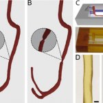 3D-gedruckte und Originalblutbahnen