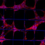Vorläuferzellen des Stütz- und Bindegewebes