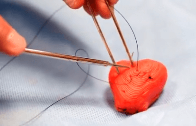 Operation besser umsetzbar