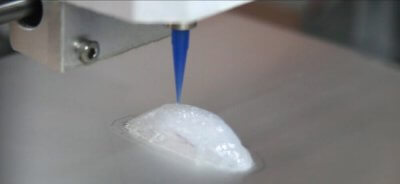 Silikon-3D-Druck von Gesichtsimplantaten