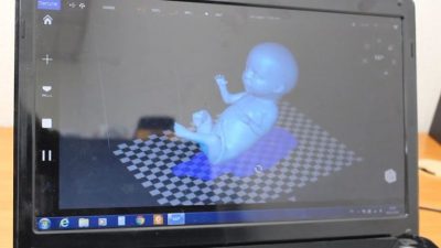 3D-Scan von einem Embryo