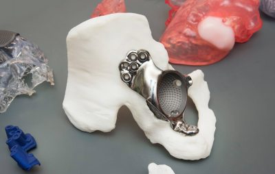 3D-gedrucktes Objekt für den Einsatz in der Medizin