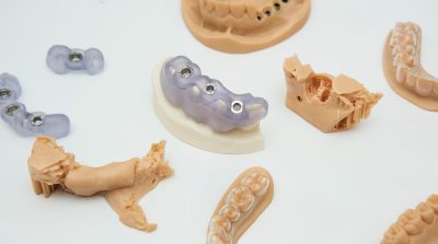 3D-gedrucktes Objekt für den Einsatz in der Medizin