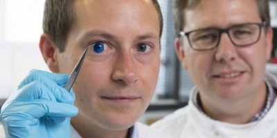 Einer der Wissenschaftler mit einer 3D-gedruckten Hornhaut