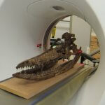 Skelett im CT-Scanner