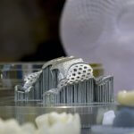 Kieferimplantat aus dem 3D-Drucker