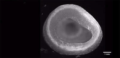 Linke Herzkammer aus dem 3D-Drucker