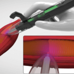 in situ Biodruck Beispiel