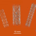 3D-gedruckte Stents aus Nitinol