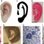 Ohr Darstellung und Ergebnisse