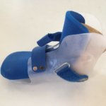 fertige Orthese für Kinder