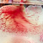 3D-Druck eines menschlichen Gefäßmodells