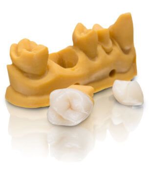 Zähne aus VarseoSmile Crown plus von BEGO