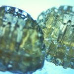 3D-Druck-Brustimplantate