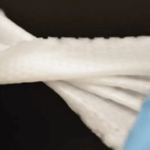 3D-gedrucktes Biomesh