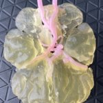 3D-Modell einer Gehirnbasis