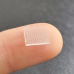 3D-gedrucktes Pflaster mit Mikronadeln