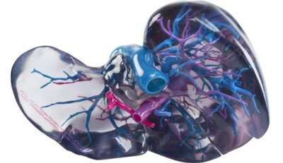 3D-gedrucktes Modell eines Organs