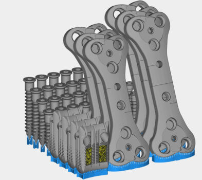 3D-gedruckte Titanimplantate