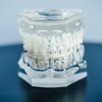 Cloud-Brackets von LightForce