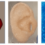 Ohrgerüst: verschiedene Ansichten