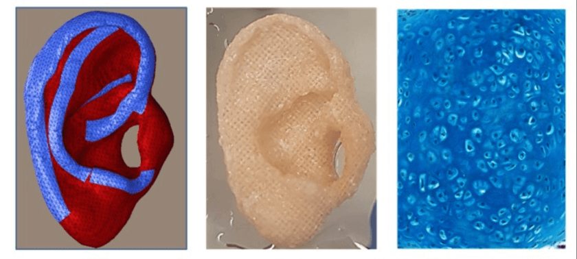 Ohrgerüst: verschiedene Ansichten