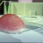 3D-gedrucktes Brustimplantat