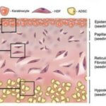 Einzelne Hautschichten