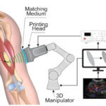 Grafik zum Direct sound printing im Körper