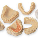 3D-Druck-Beispiele aus dem Dentallabor