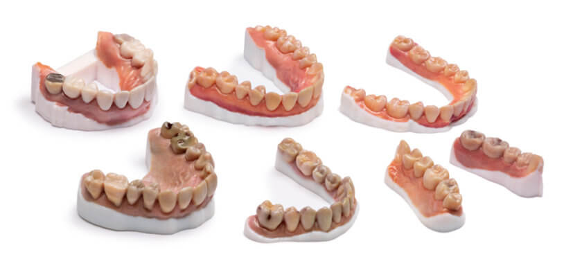 Zahnmodelle aus 3D-Drucker