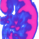 Voxelkarte eines Querschnitts einer menschlichen Niere