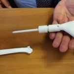 Prototyp der Handprothese