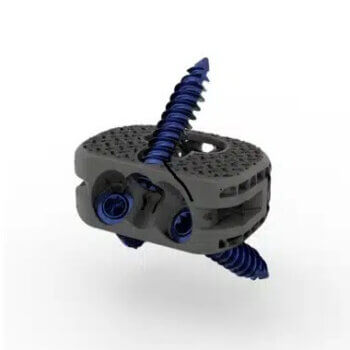 WaveForm A von Orthofix