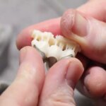 Dental 3D-Druck