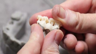 Dental 3D-Druck