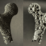 Knochenmodell aus dem 3D-Drucker