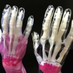 3D-gedruckte Handmodelle von IPFL, erstellt mit Stratasys J850, zeigen fortschrittliche Polyjet-Drucktechnik