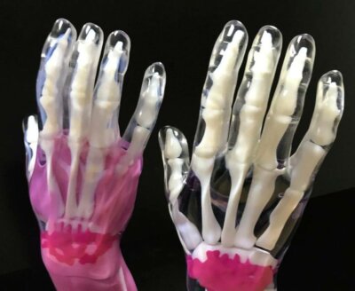 IPFL 3D-gedruckte medizinische Handmodelle mit Stratasys J850 Polyjet-Technologie 3D-gedruckte Handmodelle von IPFL, erstellt mit Stratasys J850, zeigen fortschrittliche Polyjet-Drucktechnik