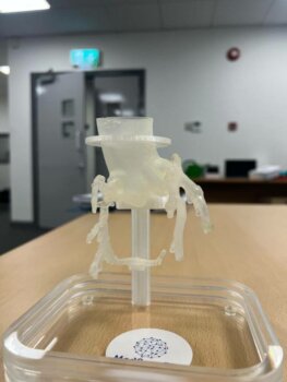 MedScan3D und Corrib Core Lab 3D-Druck in der Medizin - Aortale CTO-Chirurgie Modell