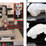 Schottische Forscher entwickeln biologische Hüftprothesen mit 3D-Druck
