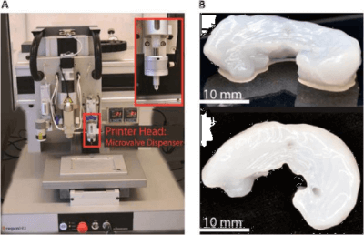 Biomedizinischer 3D-Druck einer Hüftprothese mit Stammzellenintegration
