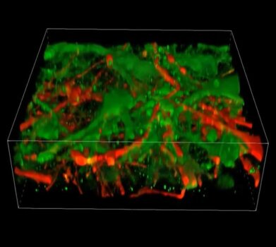 3D-gedrucktes Gehirngewebe der Universität von Wisconsin-Madison mit neuronaler Vernetzung zur Erforschung von Neurologie Neuronale Netzwerke in 3D-gedrucktem Gehirngewebe als Modell für neurologische Studien an der Universität von Wisconsin-Madison